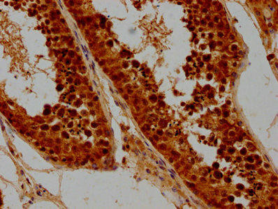 SYCE3 Antibody (PACO62131)