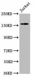 ATP2B3 Antibody (PACO62447)
