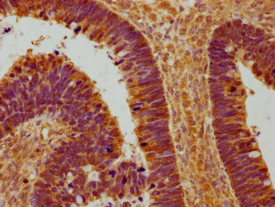 FGFBP3 Antibody (PACO62531)