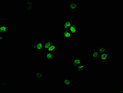 FOXN4 Antibody (PACO62579)