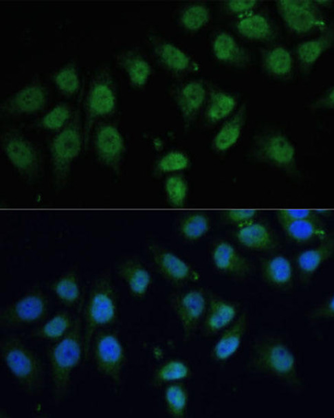 Anti-CPS1 Antibody (CAB8080)