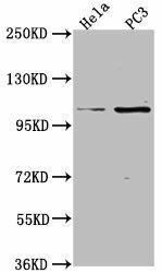 PKN3 Antibody (PACO62763)