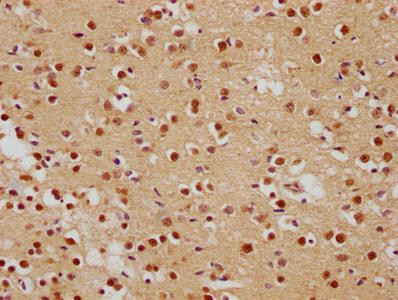 FOXO6 Antibody (PACO62899)