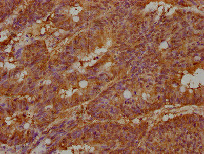 KALRN Antibody (PACO63331)