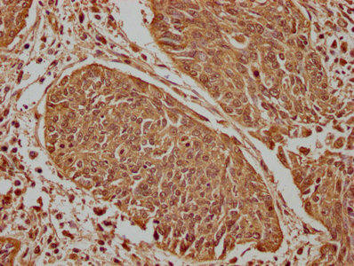 PLA2G4E Antibody (PACO63419)