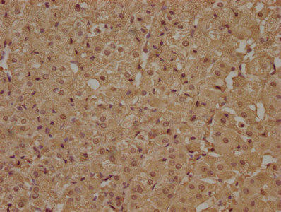 ATP6AP1L Antibody (PACO63423)