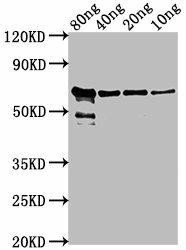 VP2 Antibody (PACO63751)