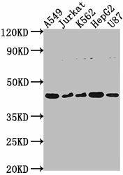 DNASE2B Antibody (PACO63975)