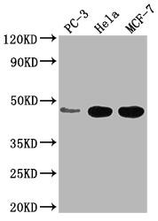 CCDC74B Antibody (PACO64187)