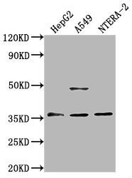 OR4D10 Antibody (PACO64395)