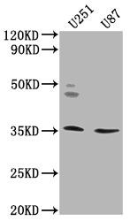 OR5K2 Antibody (PACO64407)