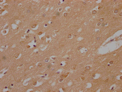 PLPPR1 Antibody (PACO64475)