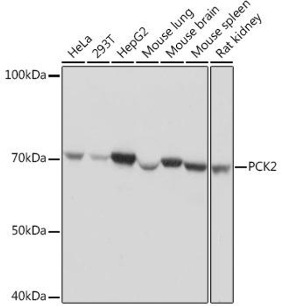 Anti-PCK2 Antibody (CAB4466)