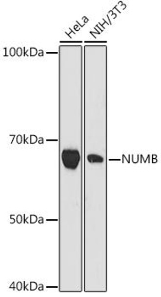 Anti-NUMB Antibody (CAB9039)