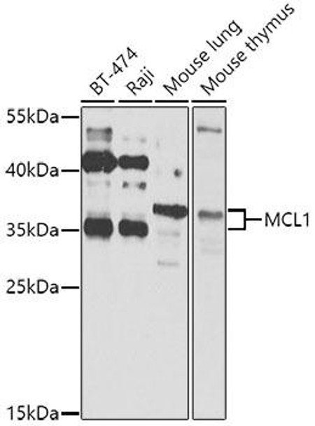 Anti-MCL1 Antibody (CAB0250)