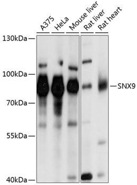 Anti-SNX9 Antibody (CAB0977)