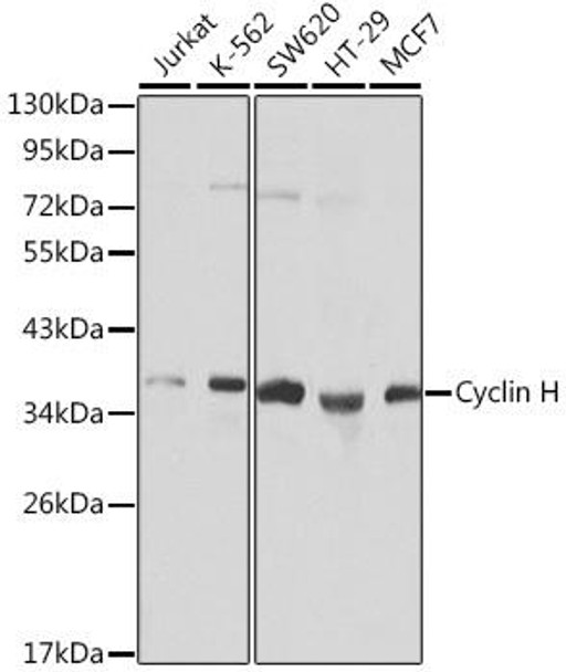 Anti-Cyclin H Antibody (CAB0995)