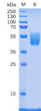 Human PSCA Recombinant Protein (hFc Tag) (HDPT0064)
