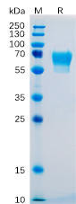 Human CD27 Recombinant Protein (hFc Tag) (HDPT0087)