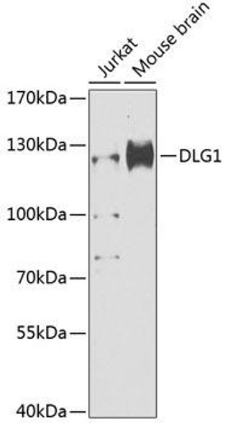 Anti-DLG1 Antibody (CAB12432)