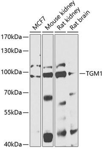 Anti-TGM1 Antibody (CAB13359)