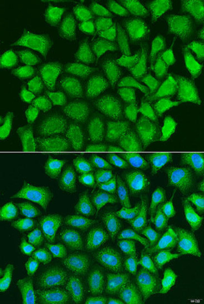 Anti-TRAF3 Antibody (CAB15106)