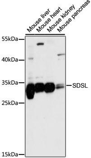 Anti-SDSL Antibody (CAB15554)