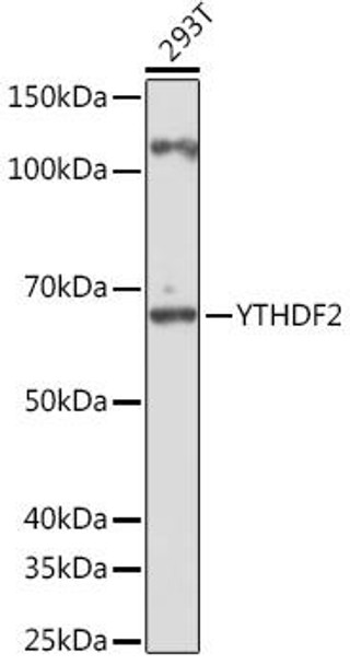 Anti-YTHDF2 Antibody (CAB15616)