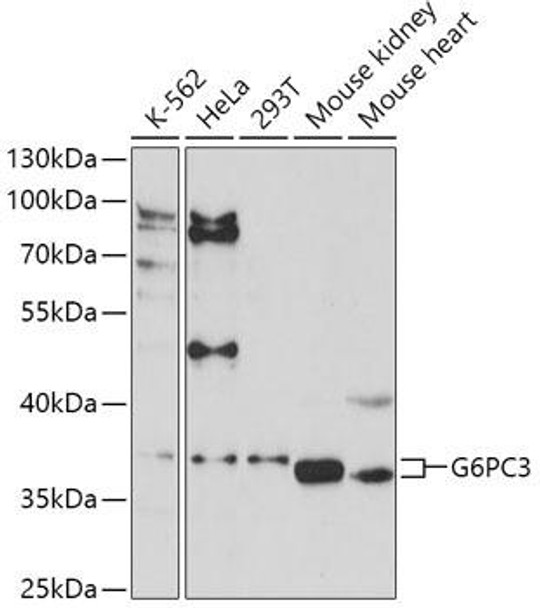 Anti-G6PC3 Antibody (CAB16234)