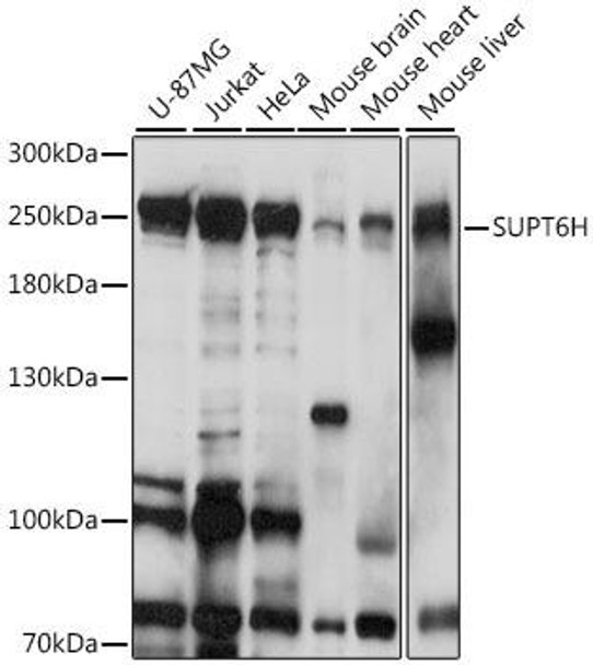 Anti-SUPT6H Antibody (CAB16434)
