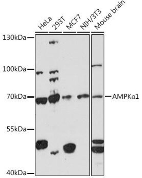 Anti-AMPKAlpha1 Antibody (CAB16960)