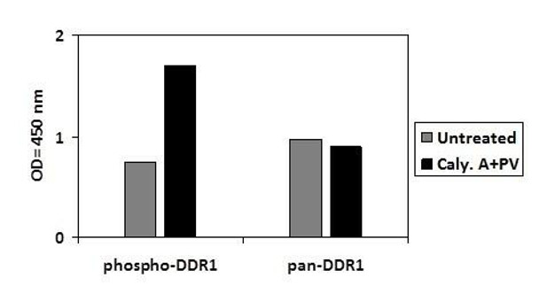 Human Phospho-DDR1 (Y792) and Total DDR1 PharmaGenie ELISA Kit (SBRS1784)