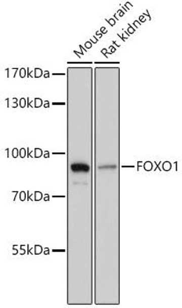 Anti-FOXO1 Antibody (CAB2934)