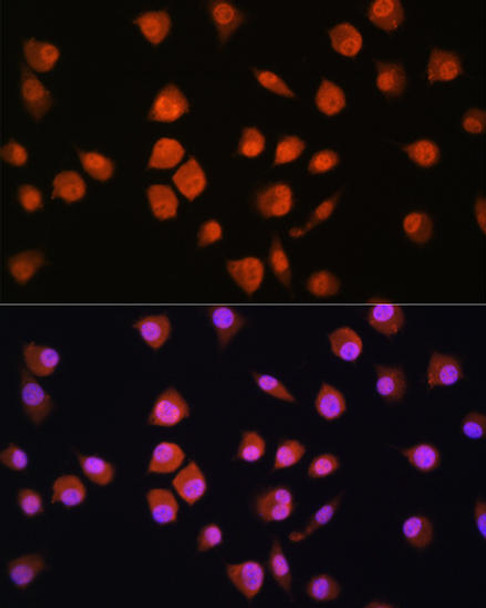 Anti-NPLOC4 Antibody (CAB3256)