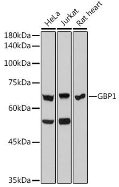 GBP1 Rabbit Monoclonal Antibody (CAB0570)