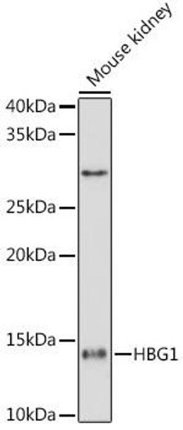 HBG1/2 Rabbit Monoclonal Antibody (CAB0704)
