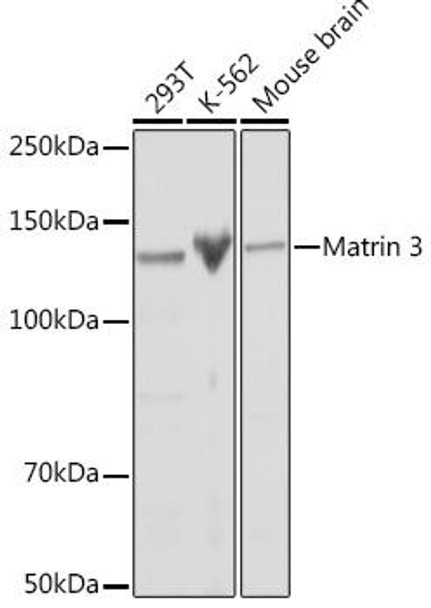 Matrin 3 Rabbit Monoclonal Antibody (CAB1027)
