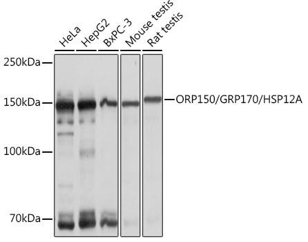 ORP150/GRP170/HSP12A Rabbit Monoclonal Antibody (CAB1042)
