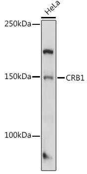 CRB1 Rabbit Polyclonal Antibody (CAB10698)