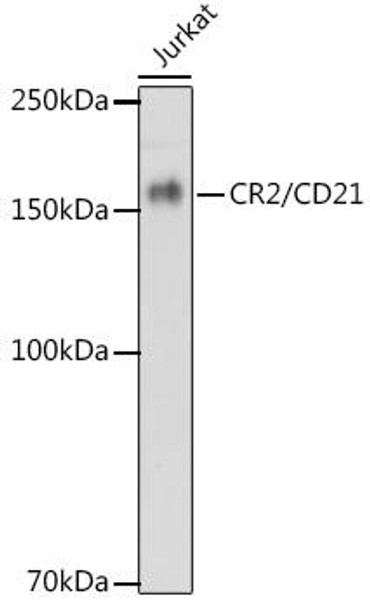 CD21 Rabbit Monoclonal Antibody (CAB1267)