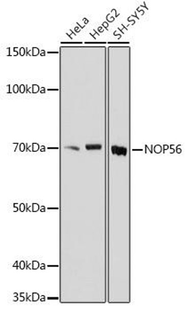 NOP56 Rabbit Polyclonal Antibody (CAB18693)