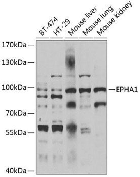 Anti-EPHA1 Antibody (CAB7328)