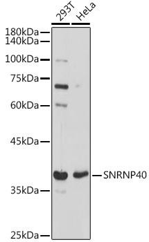 SNRNP40 Rabbit Polyclonal Antibody (CAB18856)