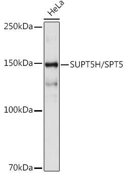 SUPT5H/SPT5 Rabbit Monoclonal Antibody (CAB19225)