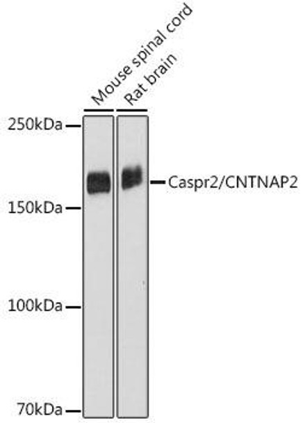 Caspr2/CNTNAP2 Rabbit Monoclonal Antibody (CAB19262)
