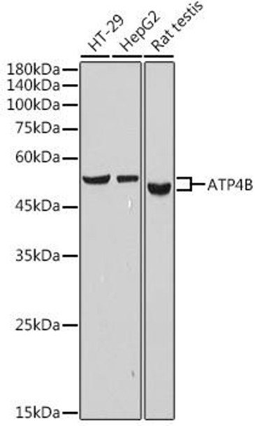 ATP4B Rabbit Monoclonal Antibody (CAB19280)
