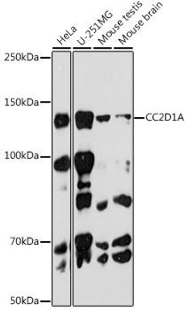 CC2D1A Rabbit Monoclonal Antibody (CAB19283)