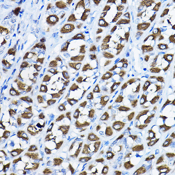 Anti-PGLS Antibody (CAB8366)