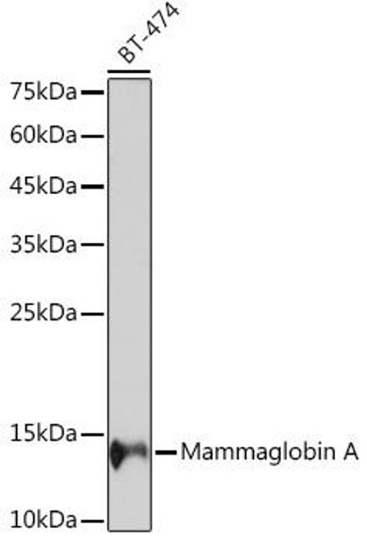 Mammaglobin A Rabbit Monoclonal Antibody (CAB19727)