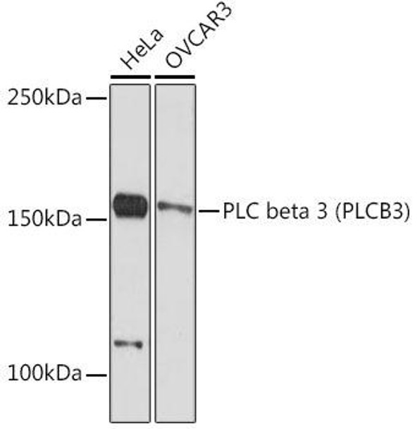 PLC beta 3 (PLCB3) Rabbit Monoclonal Antibody (CAB19738)